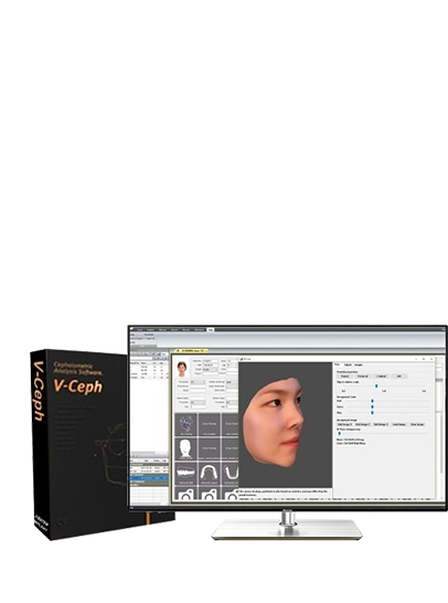 V-Ceph 3D 예측 프로그램