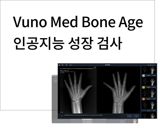 Vuno Med Bone Age인공지능 성장 검사